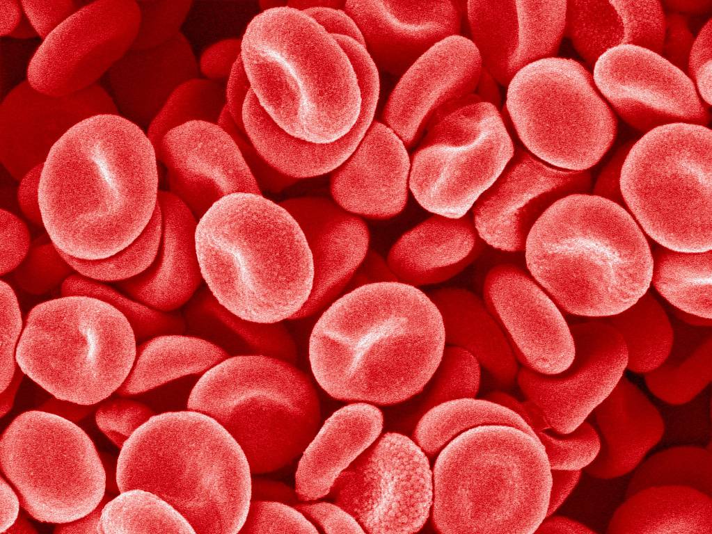 Как снизить уровень тромбоцитов в крови